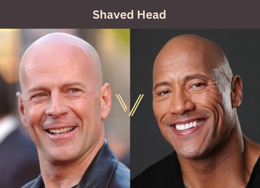 shaved head for hair loss