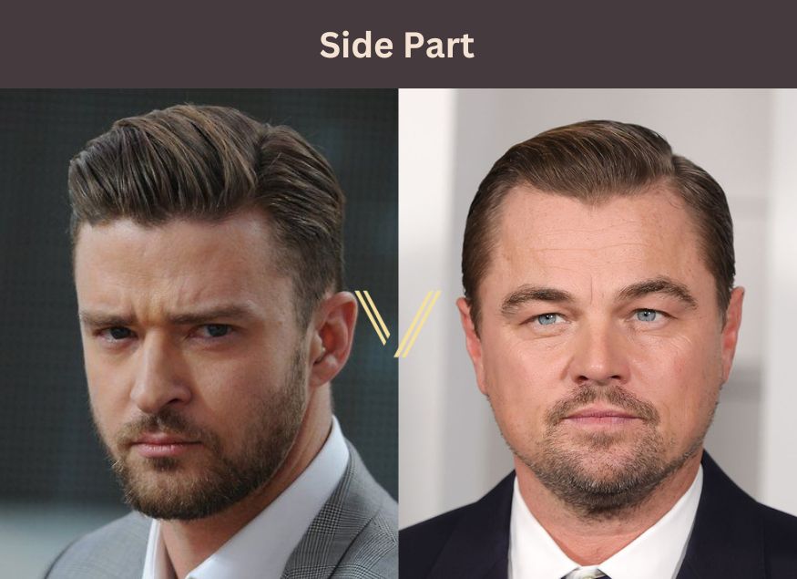 side part for hair loss