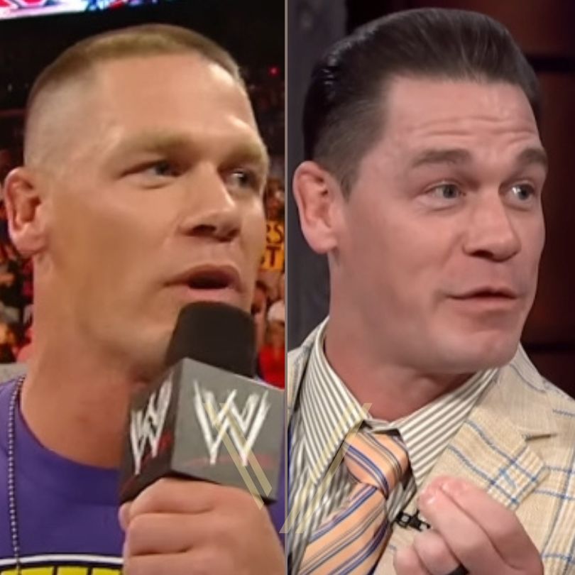 John Cena Hair Transplant: Before and After Result