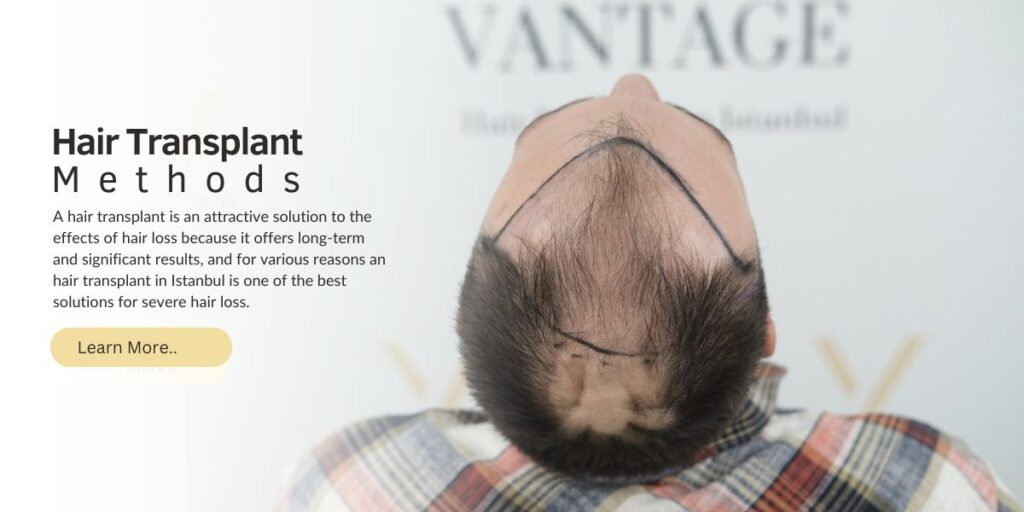 hair transplant mothods