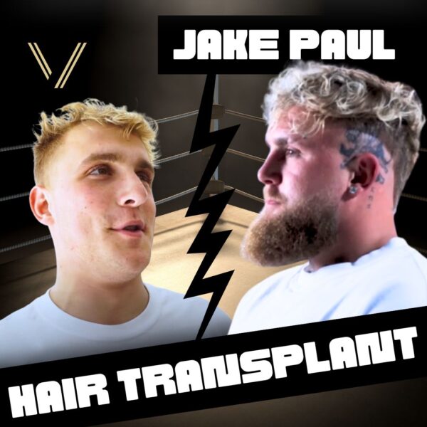 Jake Paul Hair Transplant
