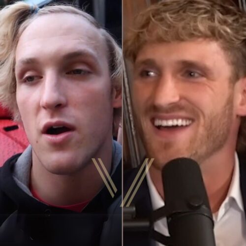 Logan Paul Before and After Hair Transplant