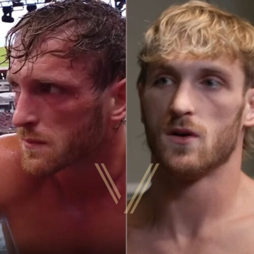 Logan Paul Before and After Hair Transplant