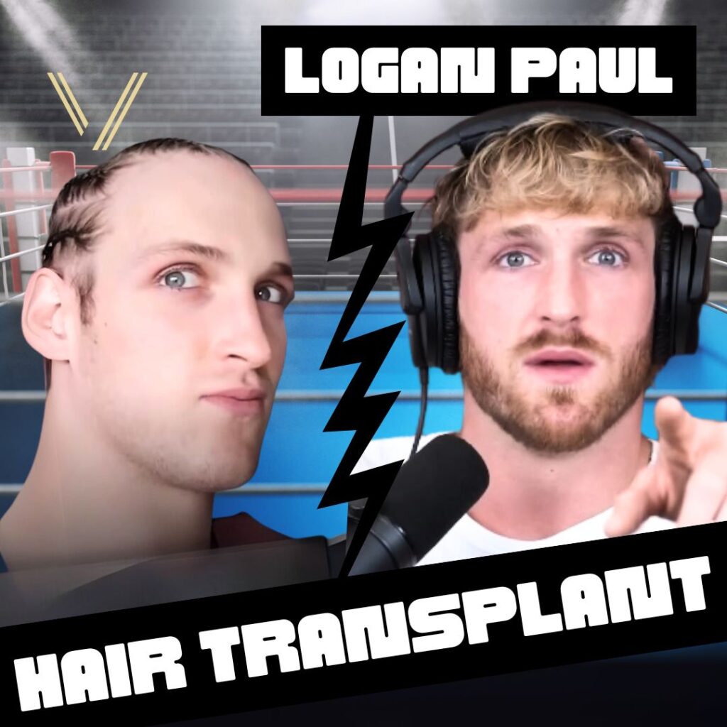 logan paul hair transplant