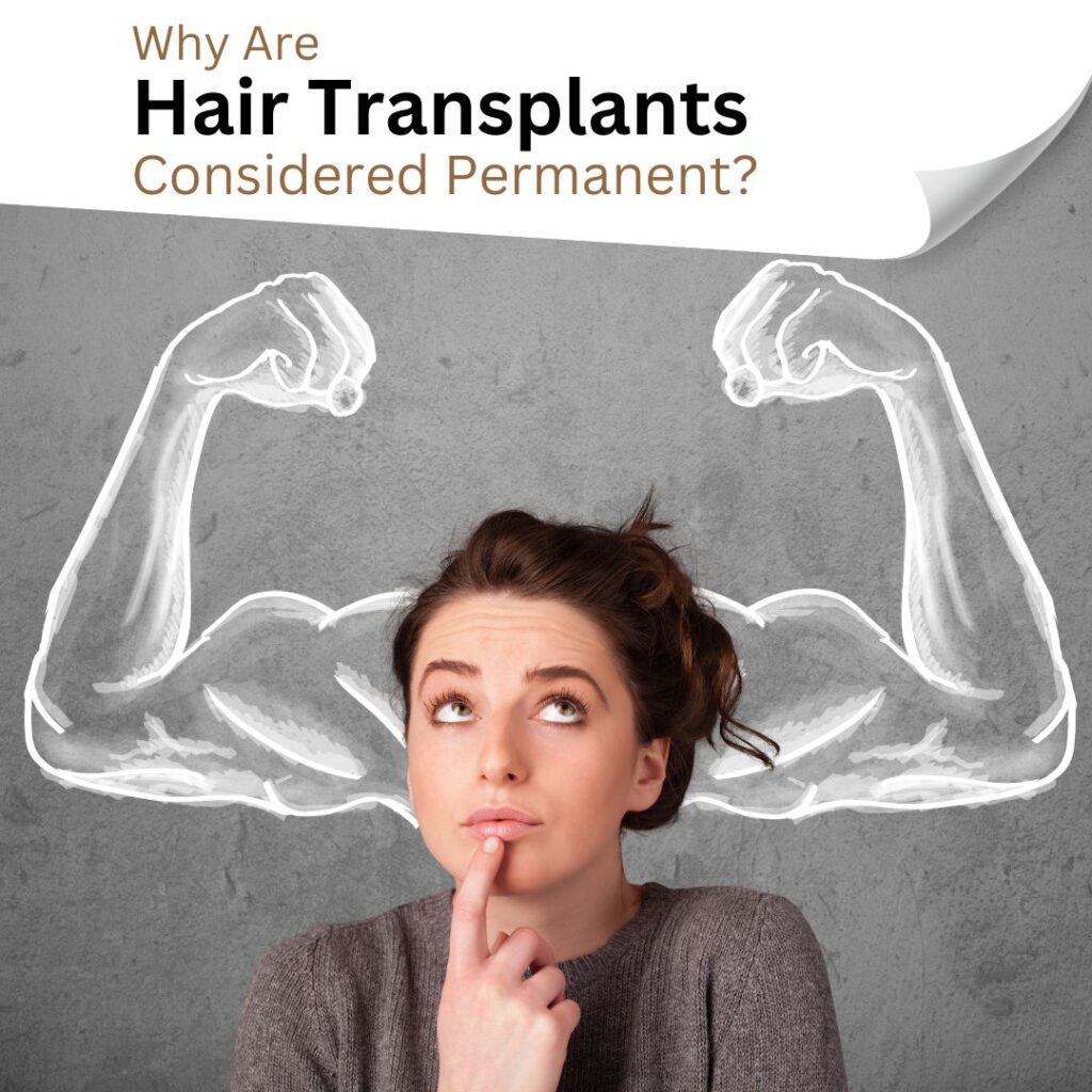 why hair transplant considered permanent