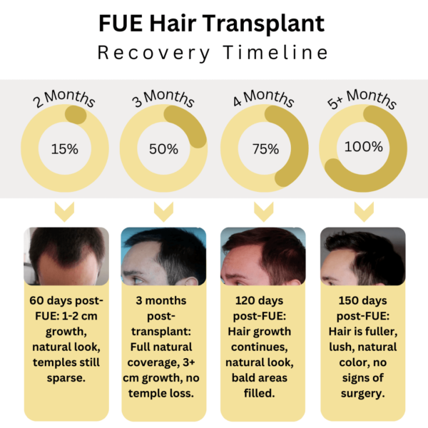 FUE Hair Transplant Recovery Timeline