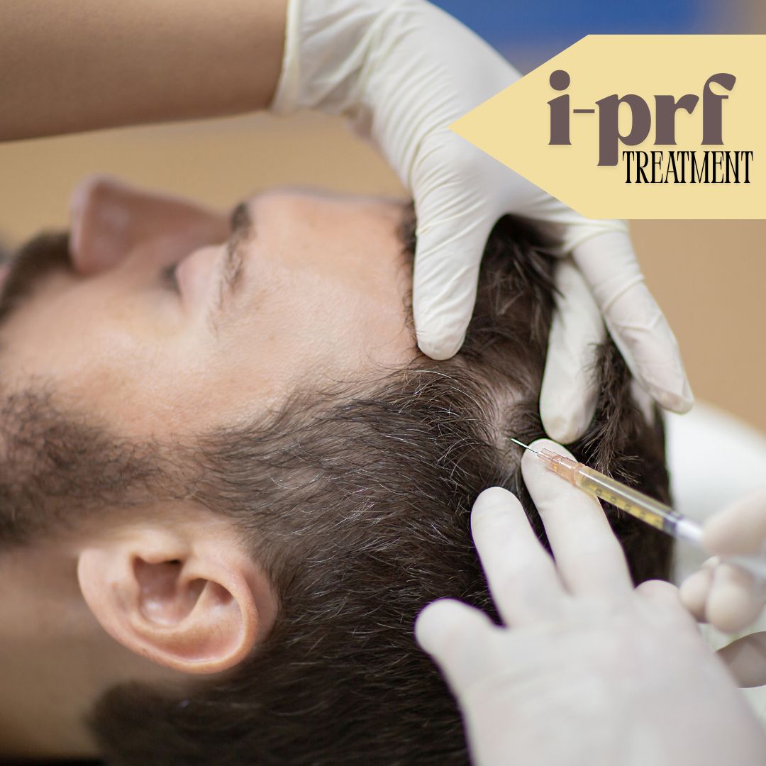 i-prf treatment hair loss