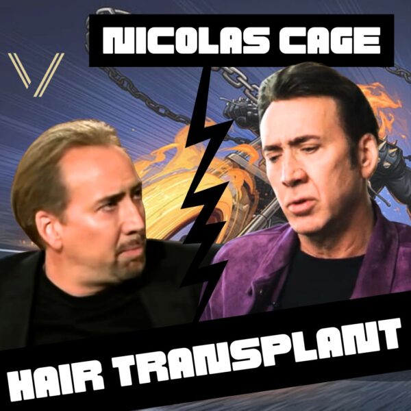 Nicolas Cage Hair Transplant: Before and After Transformation