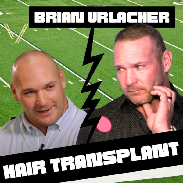 Brian Urlacher Hair Transplant