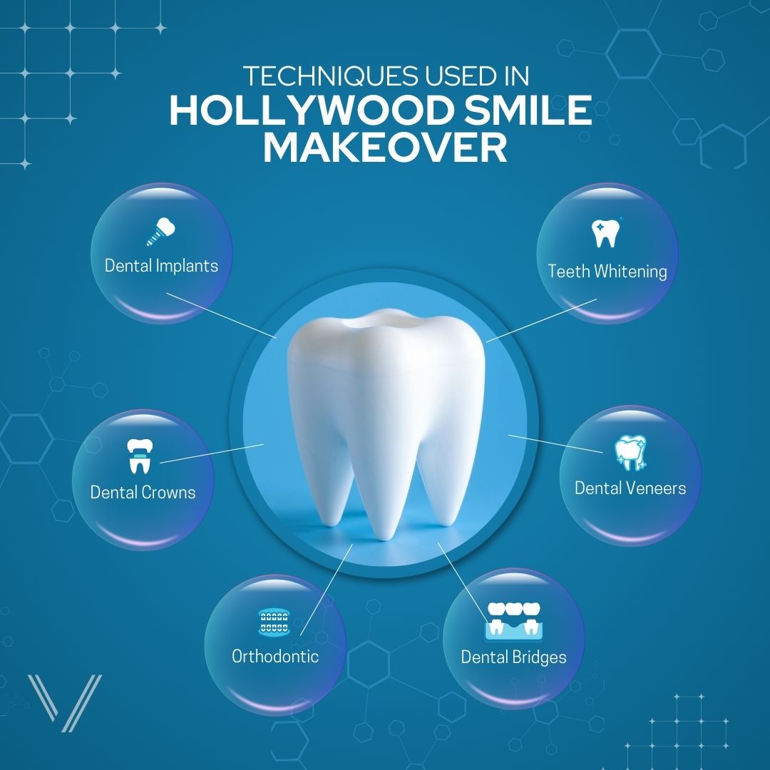 hollywood smile techniques