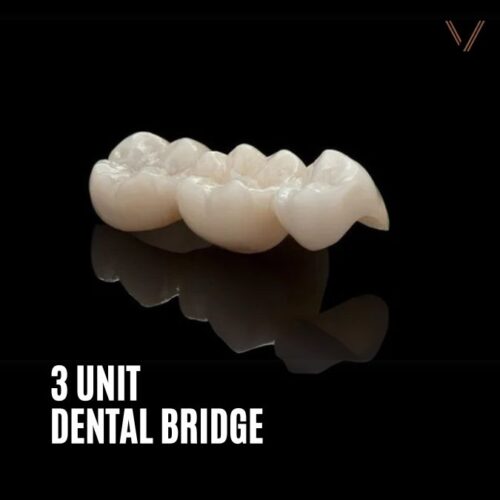 3 unit dental bridge